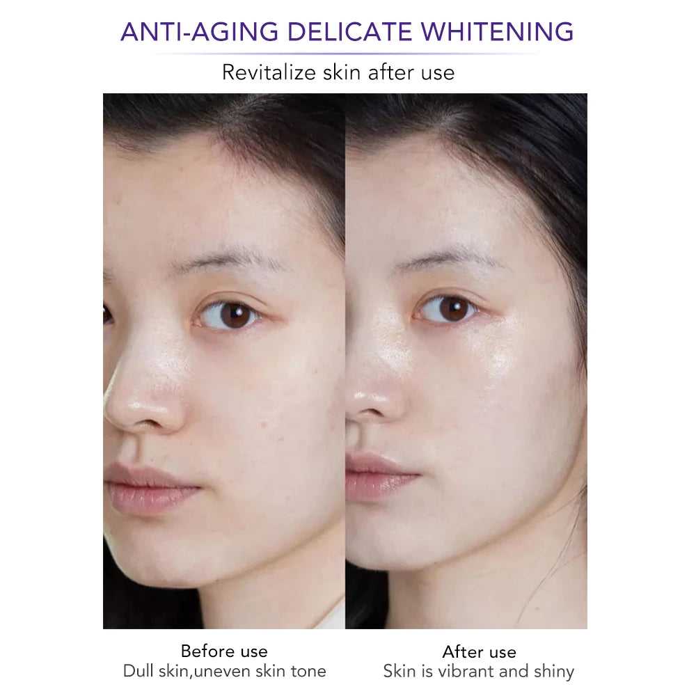 Whiten Anti-Wrinkle Freckle Face Cream