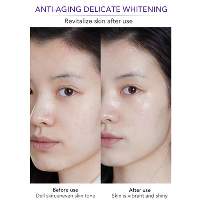 Whiten Anti-Wrinkle Freckle Face Cream