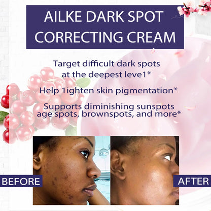 Dark Spots Remover Cream