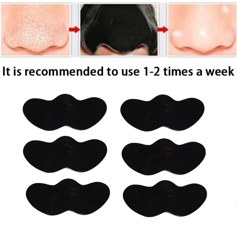 10/50/100 Pieces Deep Cleansing Blackhead Remover
