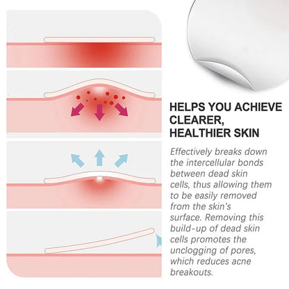 Pimple Patch Invisible Beauty Concealer Breathable Face Care