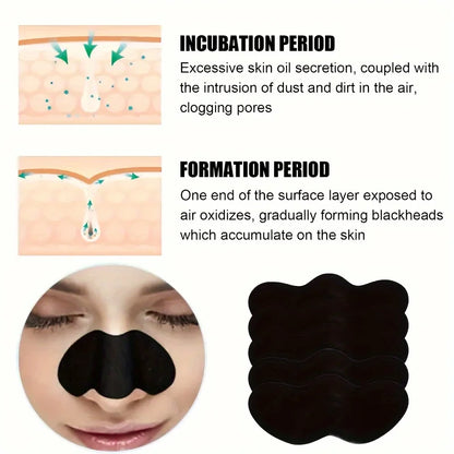10/50/100 Pieces Deep Cleansing Blackhead Remover