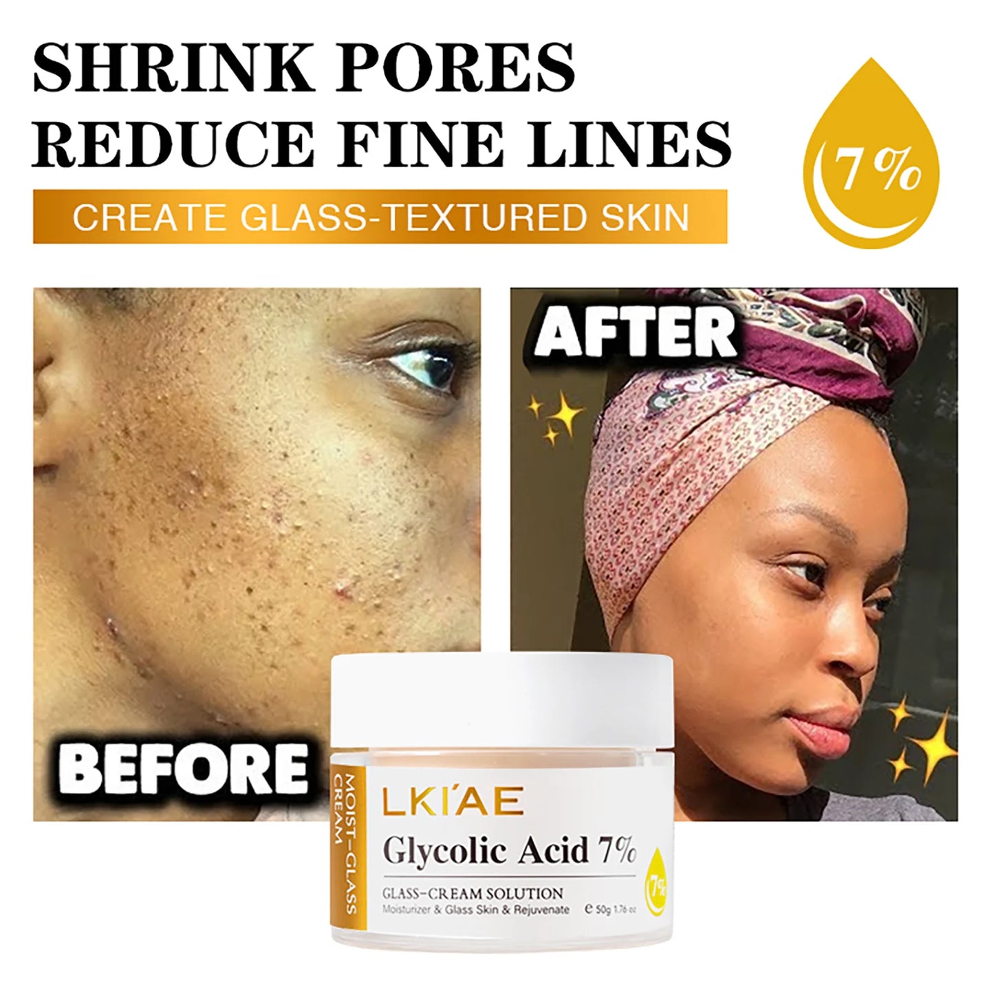 Glycolic Acid 7% Ultra-Serum-Solution
