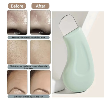 Cleansing Oil Blackhead Removal Tool