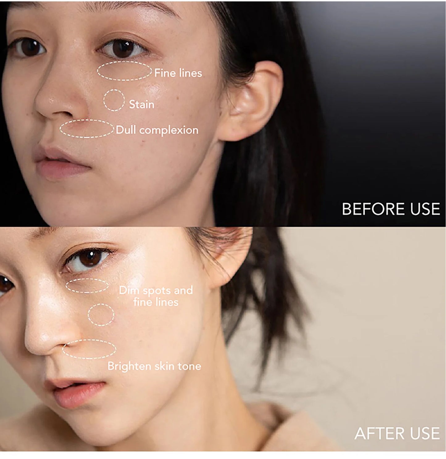 Dark Spot Remove Facial Skin Care Cream