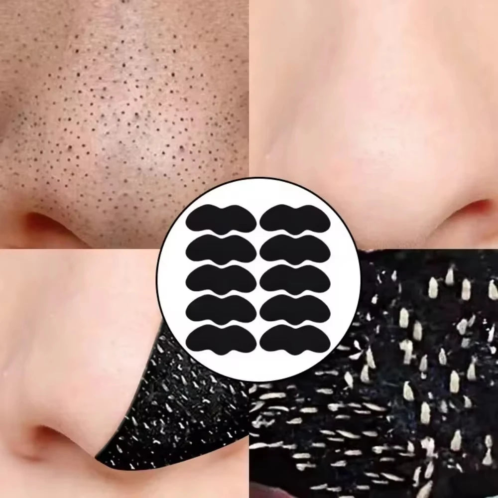 10/50/100 Pieces Deep Cleansing Blackhead Remover