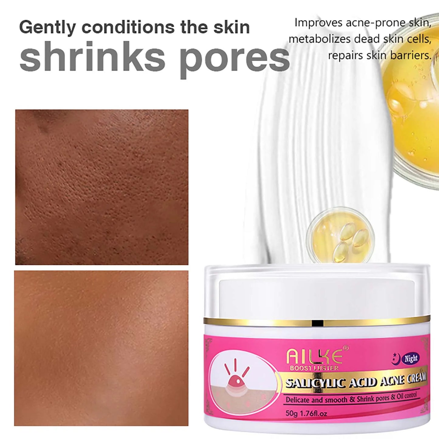 Organic Acne Face Cream
