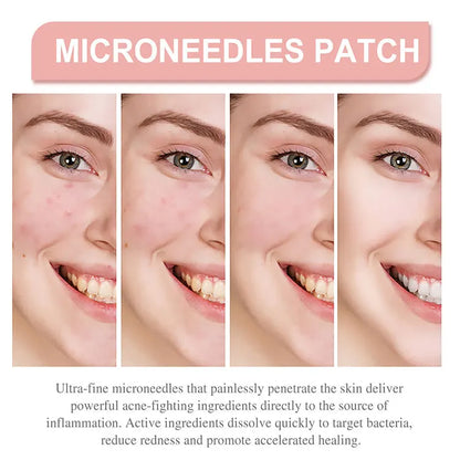 Pimple Patch Invisible Beauty Concealer Breathable Face Care
