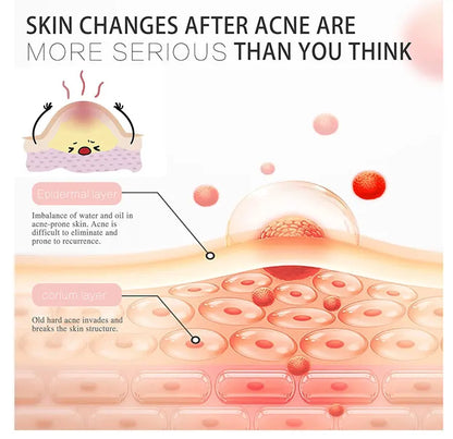 Pimple Patch Invisible Beauty Concealer Breathable Face Care