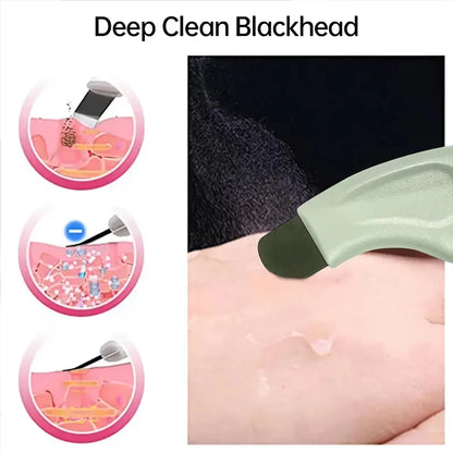Cleansing Oil Blackhead Removal Tool