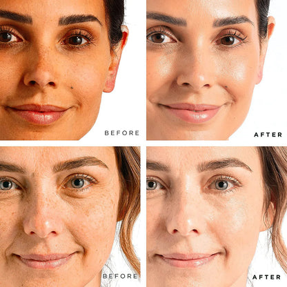 Women Anti-Aging freckles Facial Serum