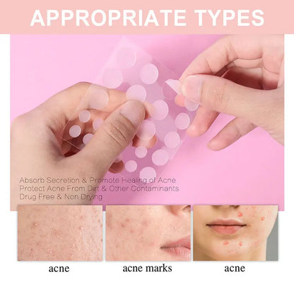 Pimple Patch Invisible Beauty Concealer Breathable Face Care