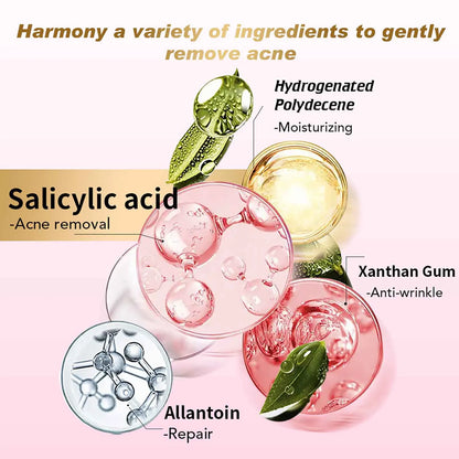 Organic Acne Face Cream