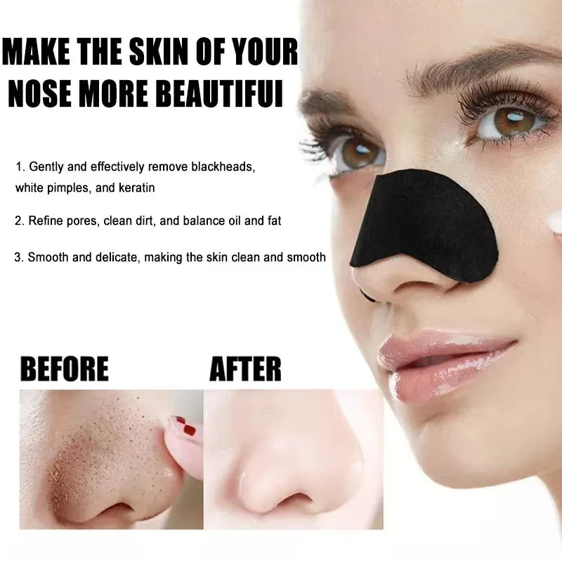 10/50/100 Pieces Deep Cleansing Blackhead Remover