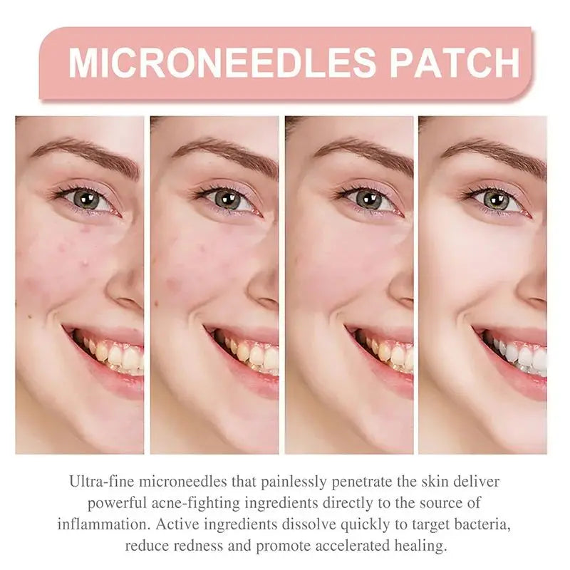 Pimple Patch Invisible Beauty Concealer Breathable Face Care