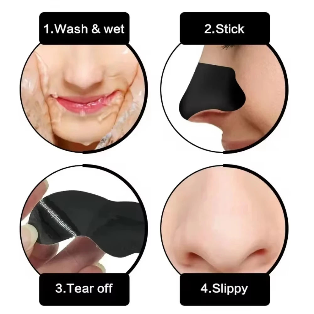 10/50/100 Pieces Deep Cleansing Blackhead Remover
