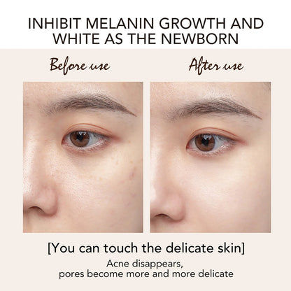 Whitening Moisturizer Day and Night Cream